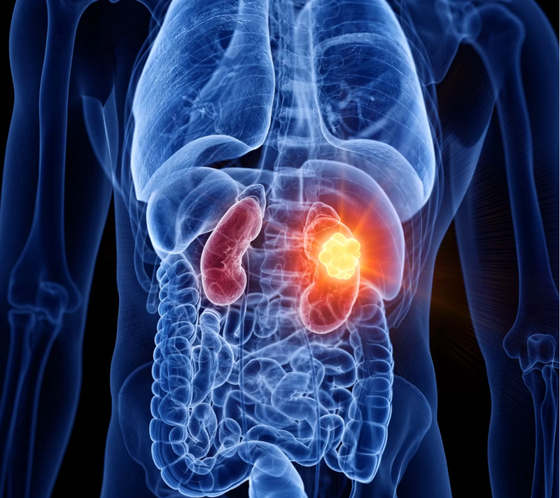 Phase III ZIRCON Study of PET Imaging Agent Meets Endpoints