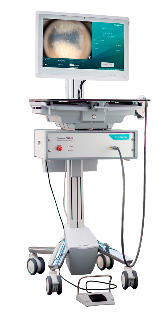 High-Intensity, Focused Ultrasound Used to Treat Basal Cell Carcinoma