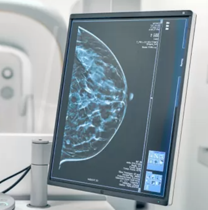 Studies Highlight AI’s Role in Detecting Aggressive Breast Cancers and Supporting Radiologists