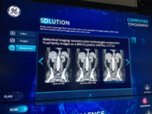 GE Healthcare Unveils Intelligence Platform