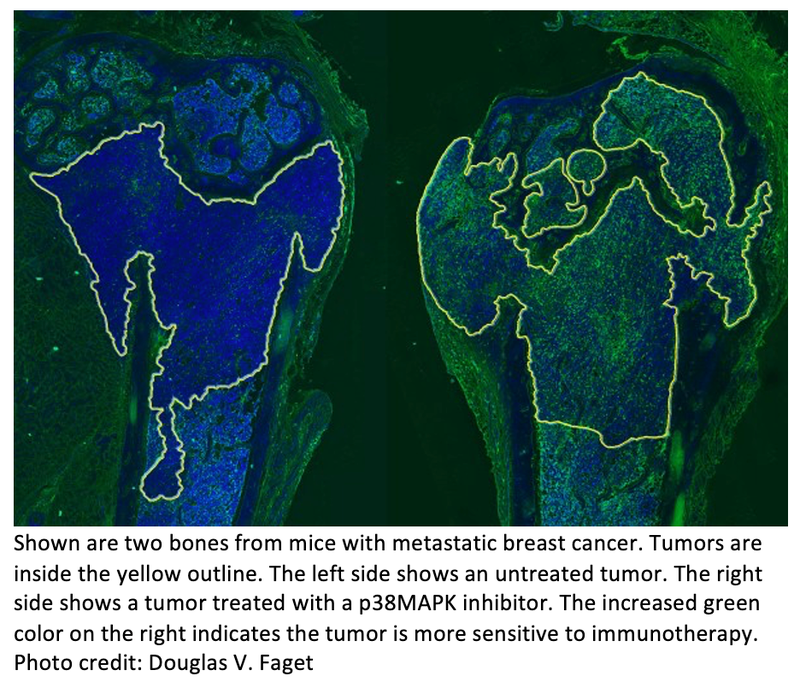 New Immunotherapy Approach Eliminates Metastatic Breast Cancer in Animal Study