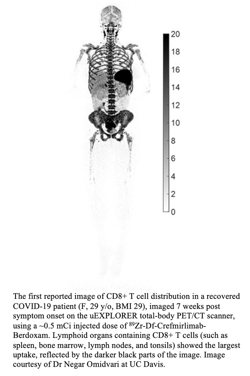 Total-Body PET Assesses Immunological Response to COVID-19