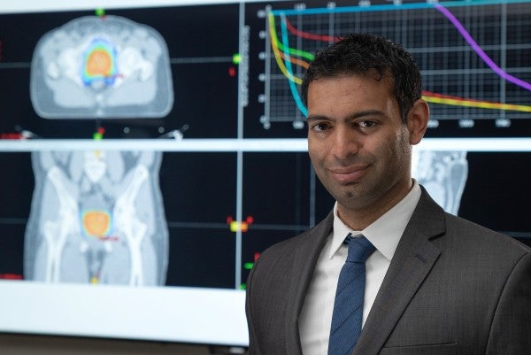 Model helps predict which patients will benefit most from PSMA PET scan