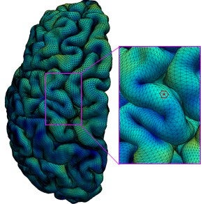 Scientists use High-Resolution MRI to Create New Map of Young Human Brain Cortex