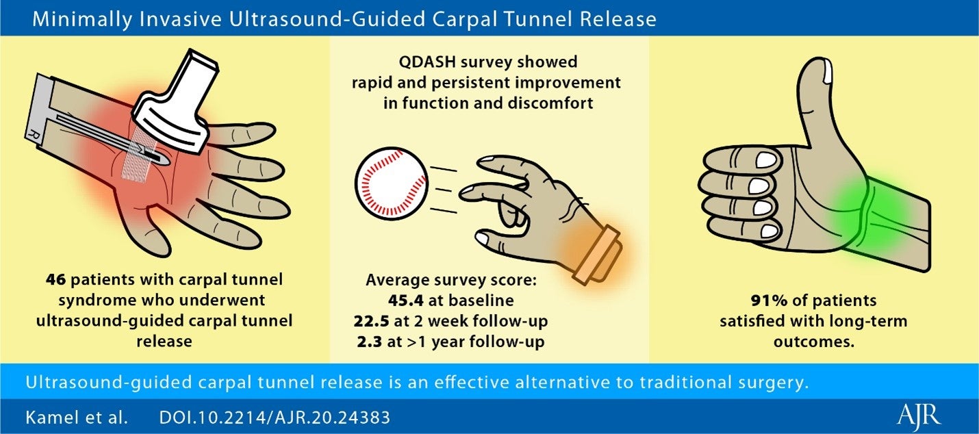 Ultrasound-Guided Carpal Tunnel Release Improves Long-Term Outcomes
