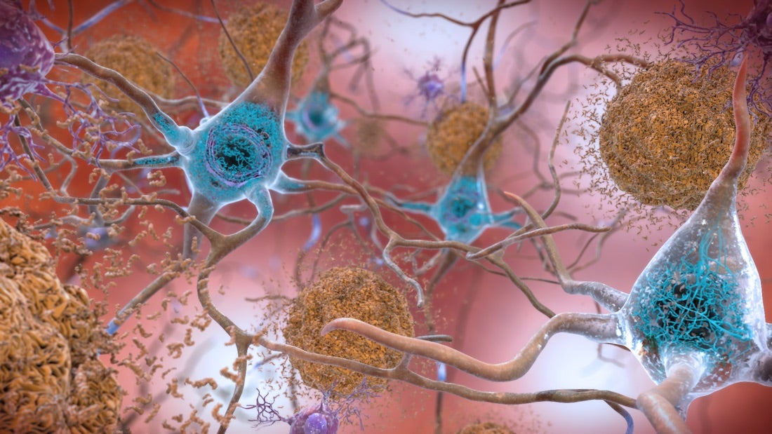 UTSW Scientists Eliminate Alzheimer’s Feature in Animal Model