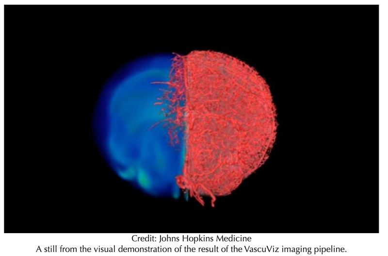 New Imaging Approach Enables Visualization of a Tissue’s Vasculature Structure