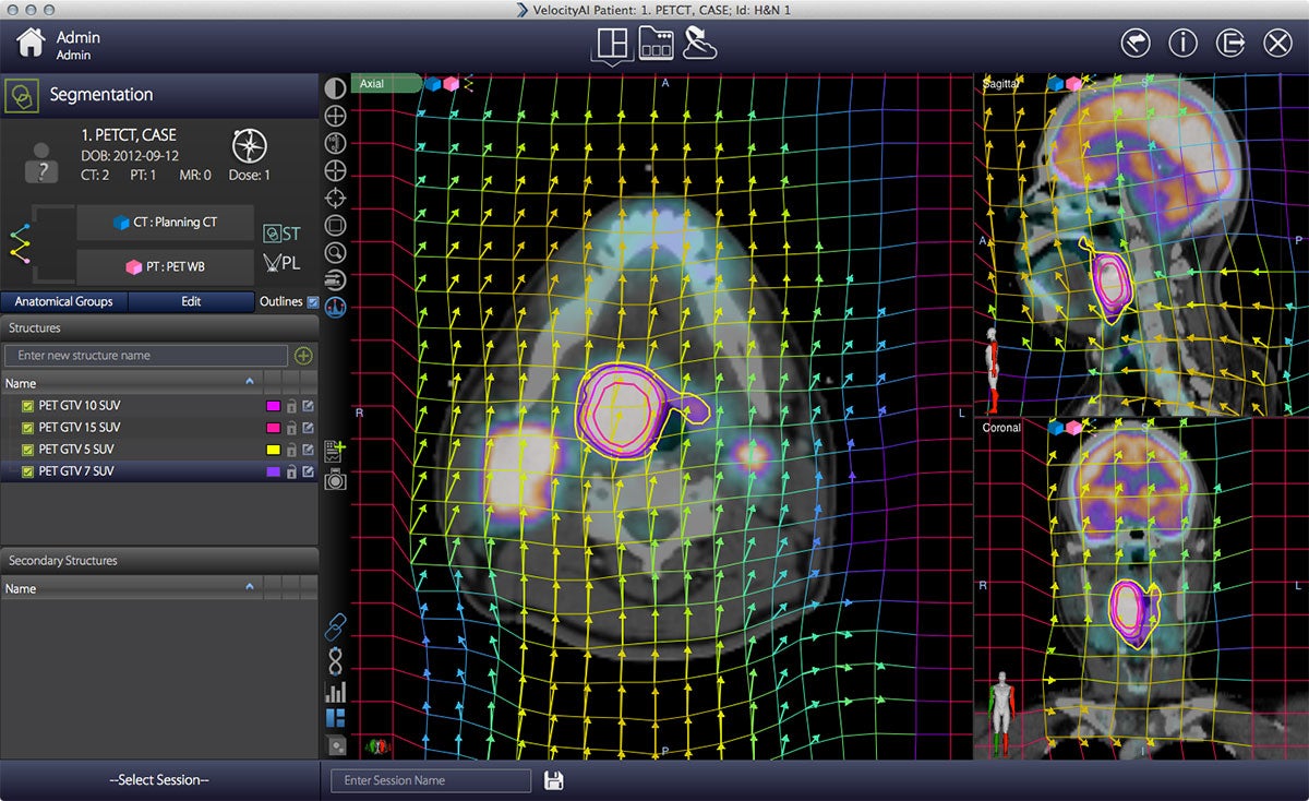 Varian showcasing advanced cancer care solutions at ESTRO 37