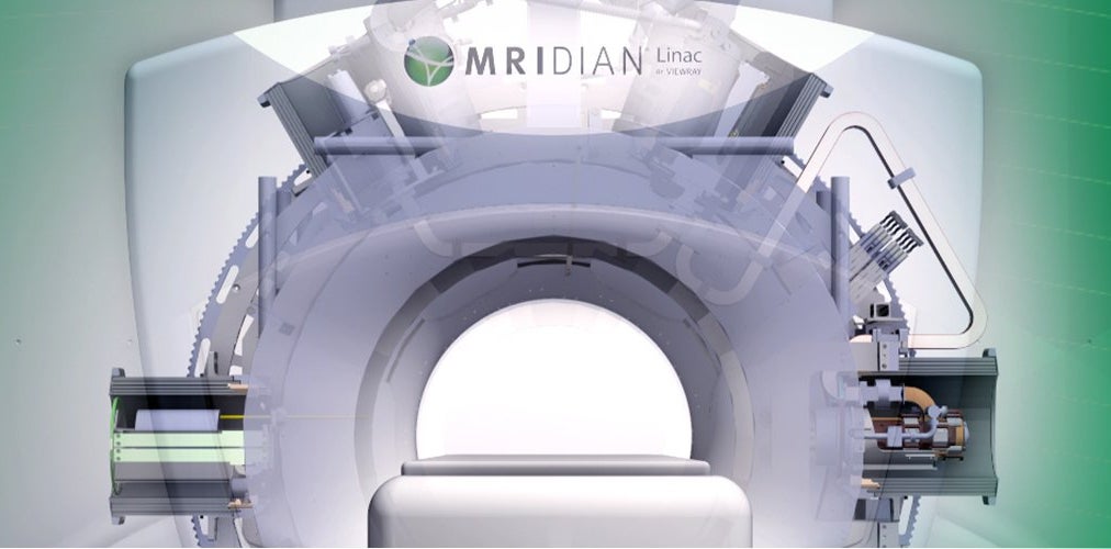 Study Explores Single-fraction Stereotactic Ablative Body Radiotherapy