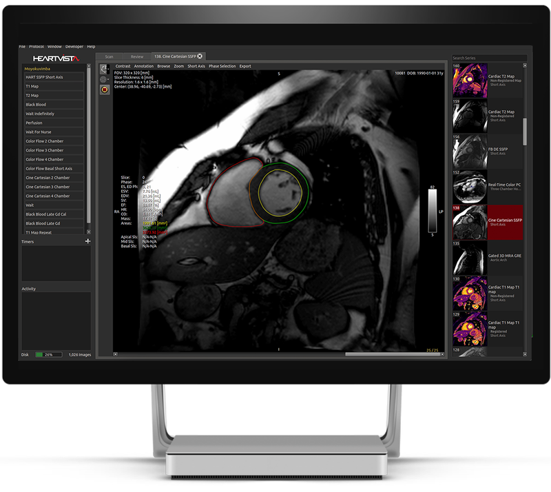 AI-Based Software Reduces Cardiac MRI Scan Time