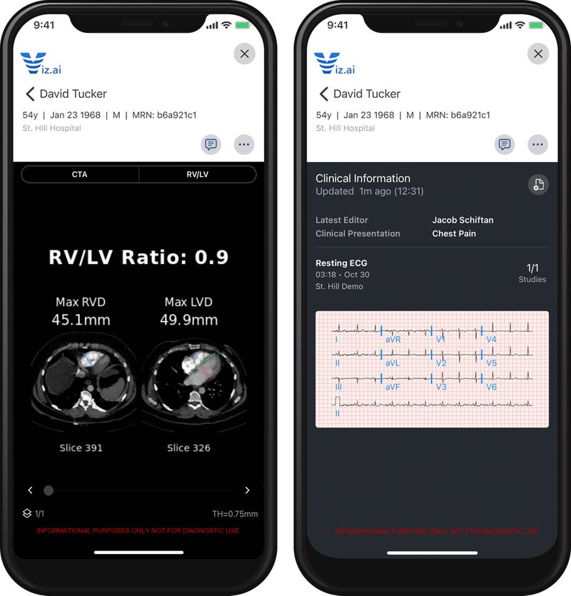 Viz Cardio Suite Brings AI to Disease Detection, Workflow Optimization