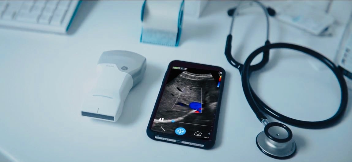 GE Launches Wireless Pocket-sized Ultrasound with Whole-body Scanning Capabilities