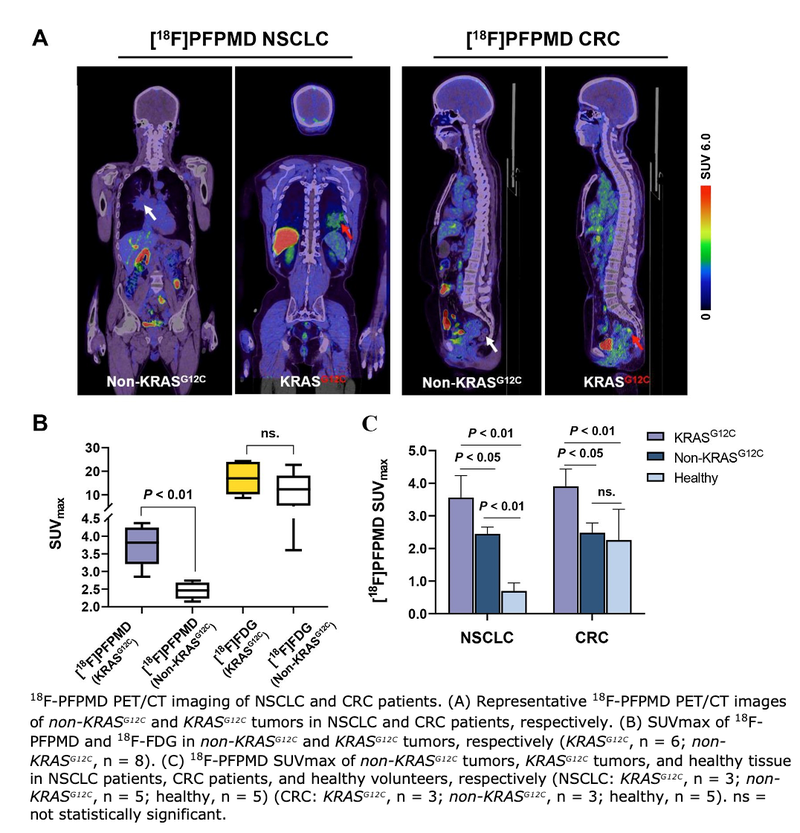 Novel PET Tracer Noninvasively Identifies KRAS Mutation