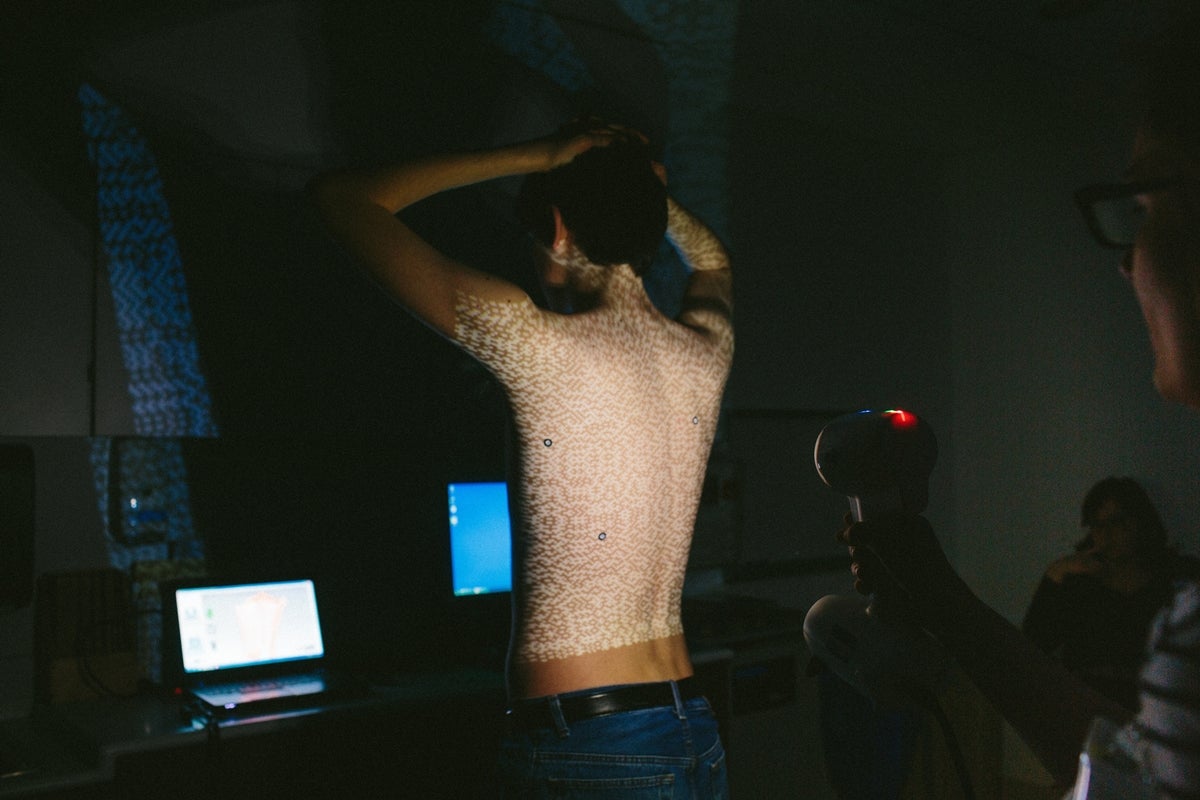 White light scanner - Alternative to CT for assessment of pediatric chest deformities?