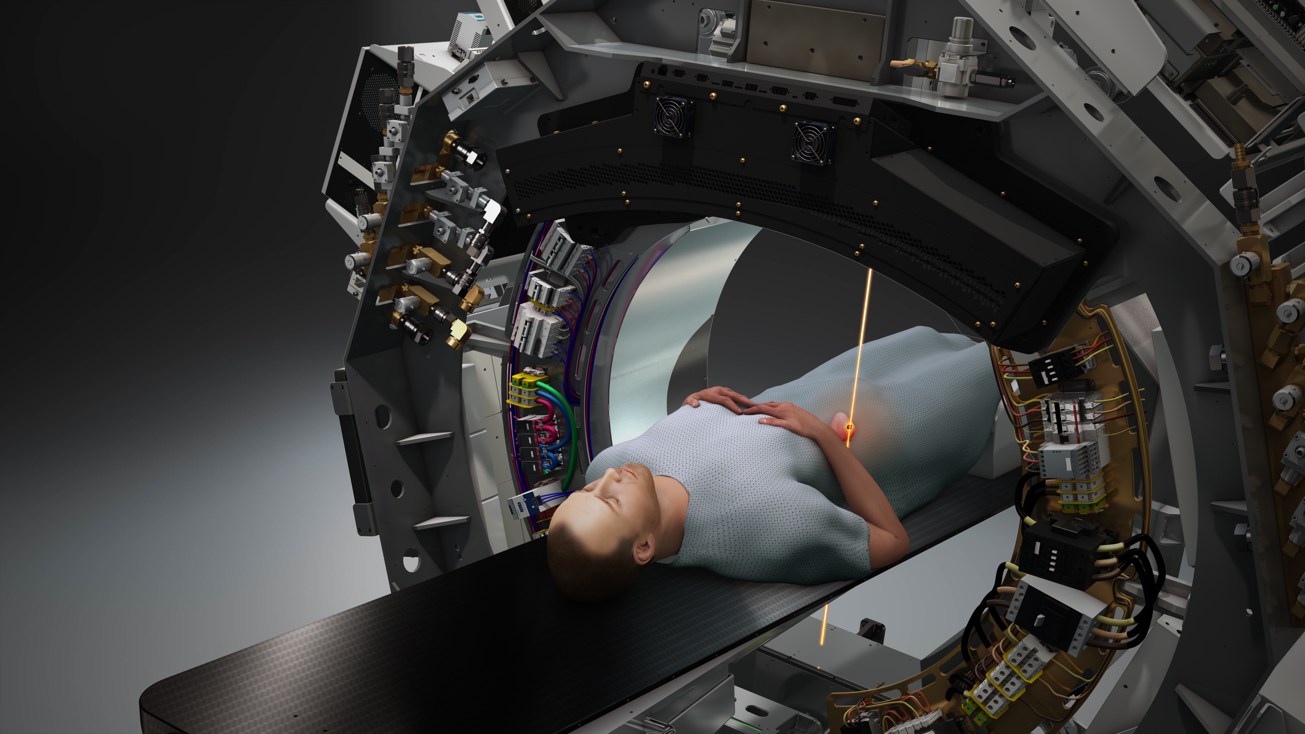 Lantheus, RefleXion Collaborate to Evaluate PSMA PET Agent with Biology-Guided Radiotherapy