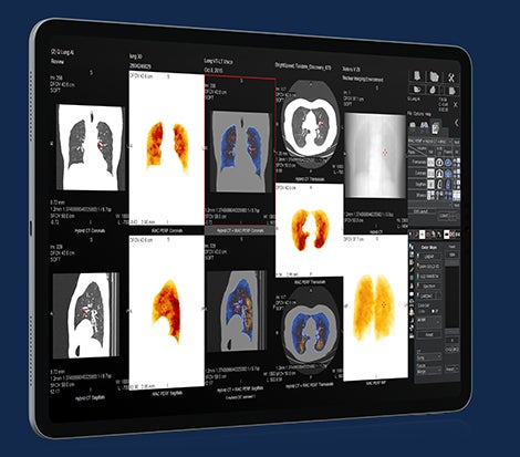 GE Launches Virtual Server Solution with AI-enabled Applications for Nuclear Medicine