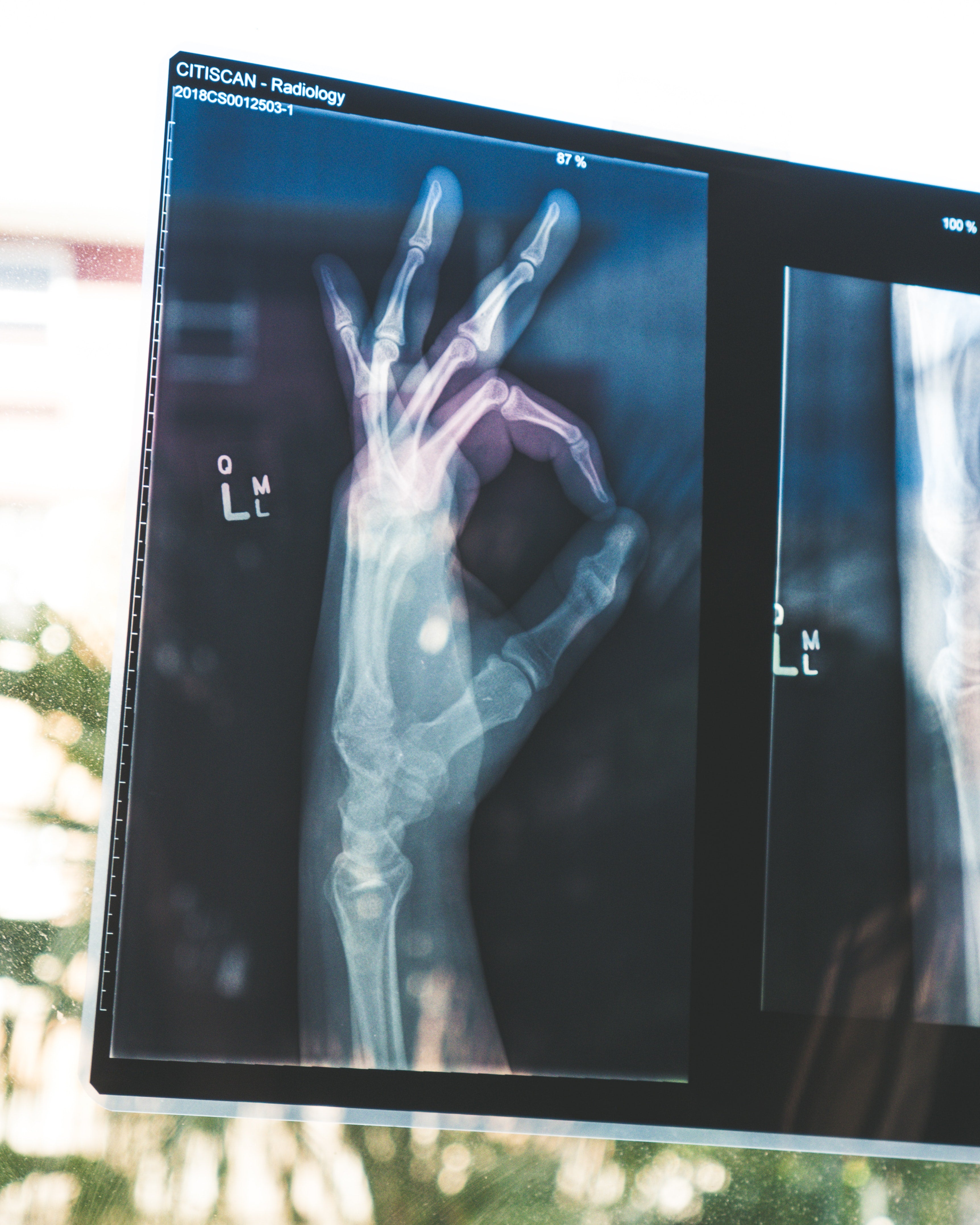 Platform Enables Analysis of Unstructured Imaging Data from Devices and VNAs