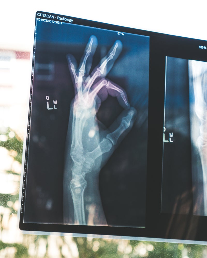 Mireye Launches AI-based Software for X-ray Patient Positioning