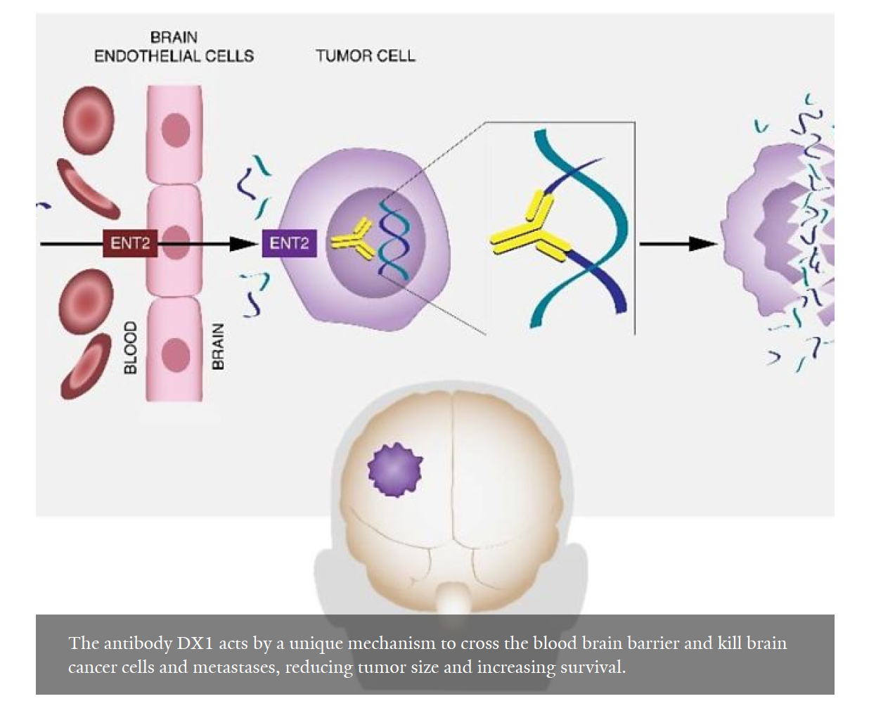 Study Reveals New Pathway for Brain Tumor Therapy