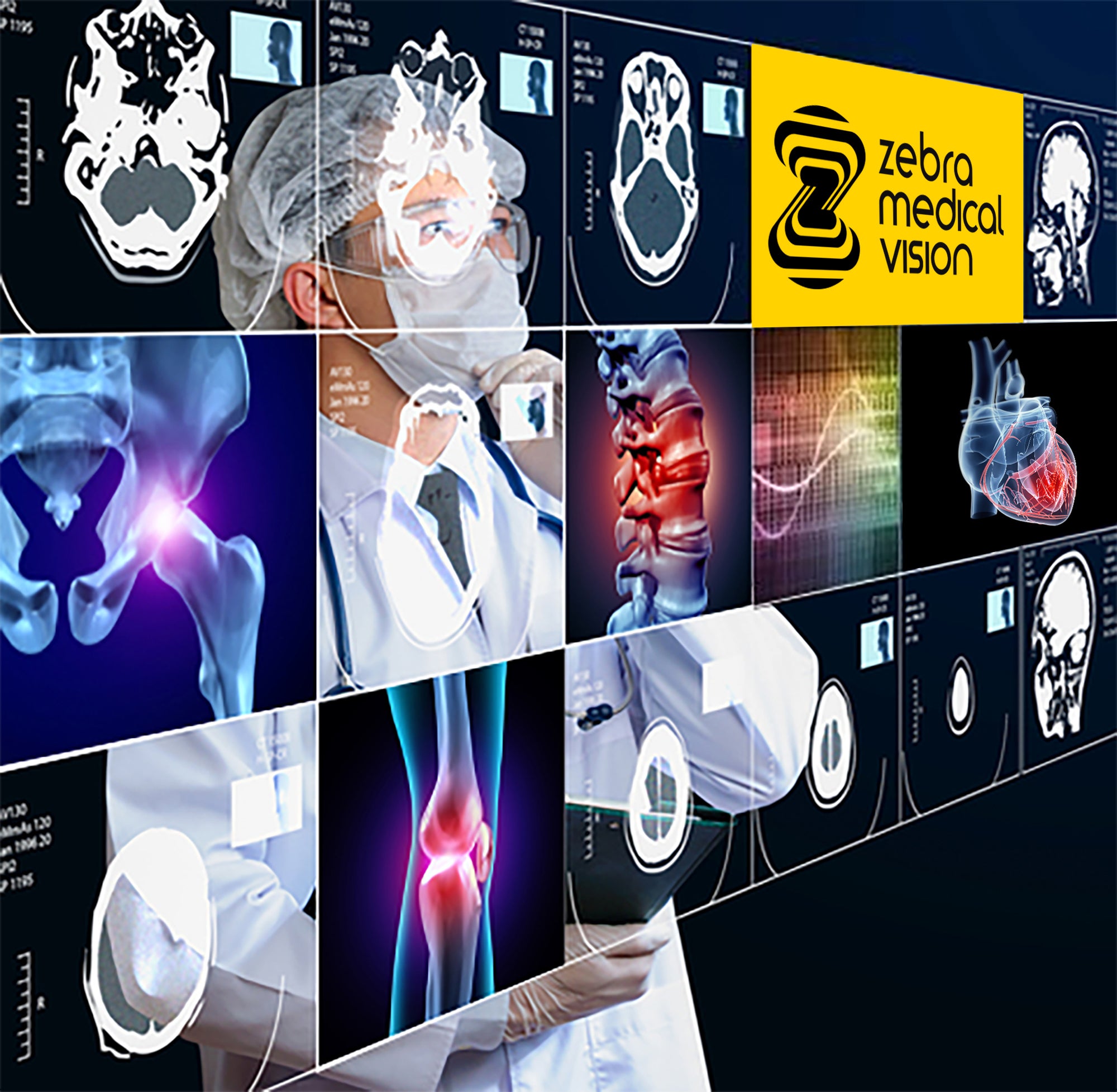 Coronary Artery Calcium Solution Receives 8th FDA Clearance