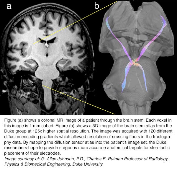 Vision of the future: creating precision 3-D model of human brain stem using 7 Tesla MRI images
