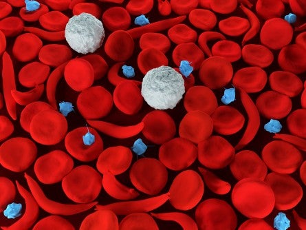 Research Addresses CAR T Cell Therapy Relapse and Resistance in Blood Cancers