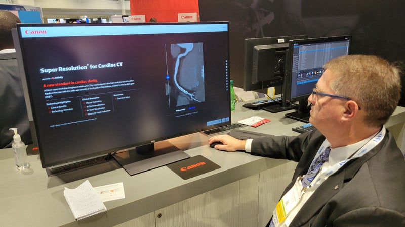 New Canon Technologies at RSNA 2022 Include AI-Driven CT Data Reconstruction