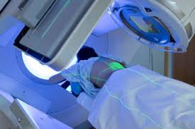 ASTRO Updates Rectal Cancer Radiation Therapy Clinical Guideline
