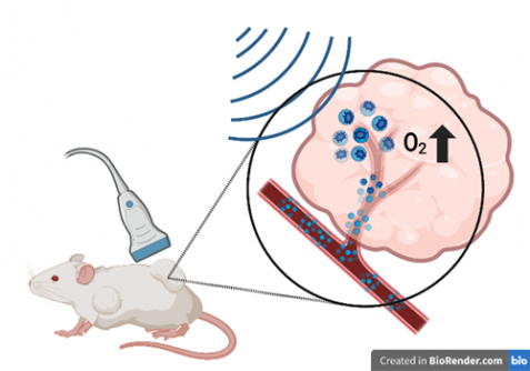 Delivering Oxygen to Tumors Could Overcome Radiation Therapy Resistance