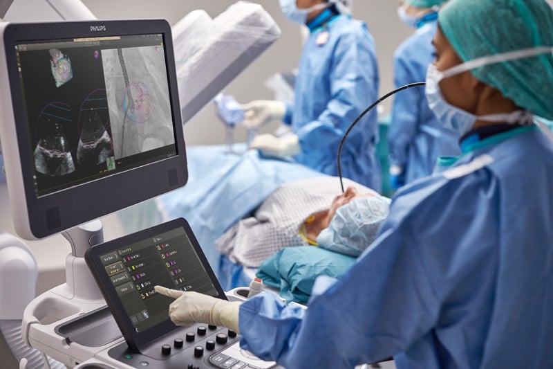New Release of EchoNavigator Provides Greater Control of Live Fusion Imaging