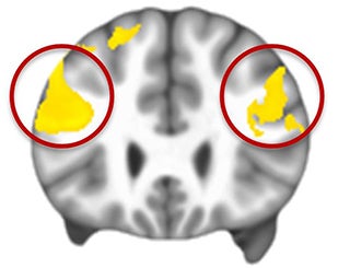 Wayne State Medical School, Mathematics Faculty Team up to Analyze fMRI Data