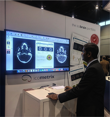Icometrix and Siemens to partner on AI solutions for brain MRIs