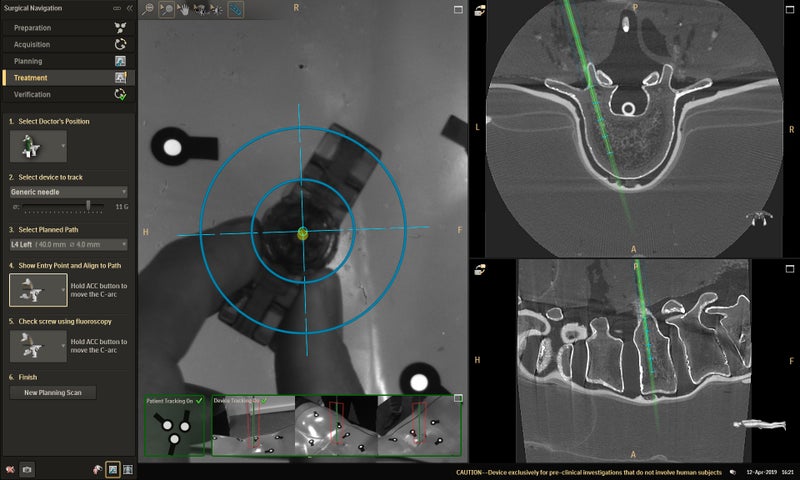 Philips Introduces Augmented Reality Surgical Navigation Solution in Japan