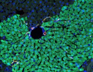 Newly Discovered Cells Regenerate Liver Tissue Without Forming Tumors