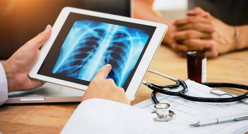 Targeted Therapy With Immunotherapy Effective in Immune-Resistant NSCLC