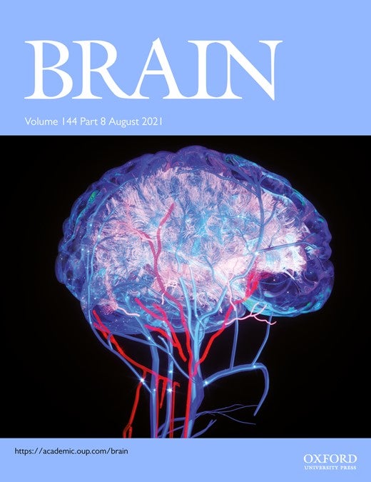 Genetic Variant Increases Risk of Alzheimer’s and COVID-19