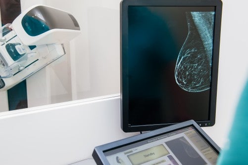 GE HealthCare Launches Invenia ABUS Prime and ABUS StreamVue