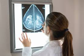 FDA Adjusts MQSA Rules During COVID-19 Pandemic