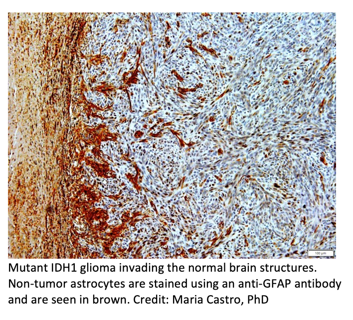 Researchers Find Gene Responsible for Radiation Resistance in Low-Grade Gliomas