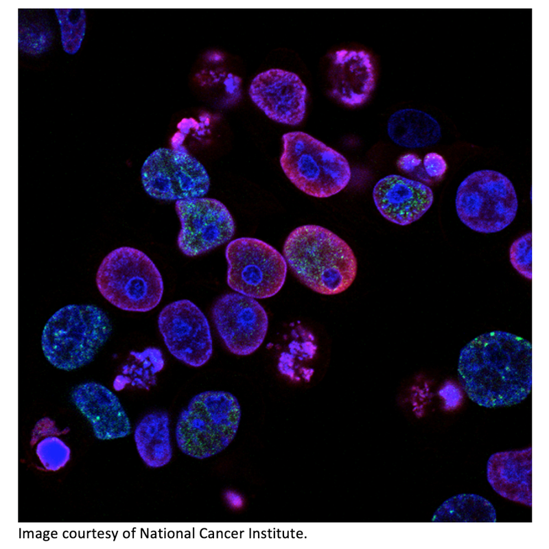 First Patient Enrolled in Phase III Study of Radiotherapy-activated NBTXR3 in Head and Neck Cancer