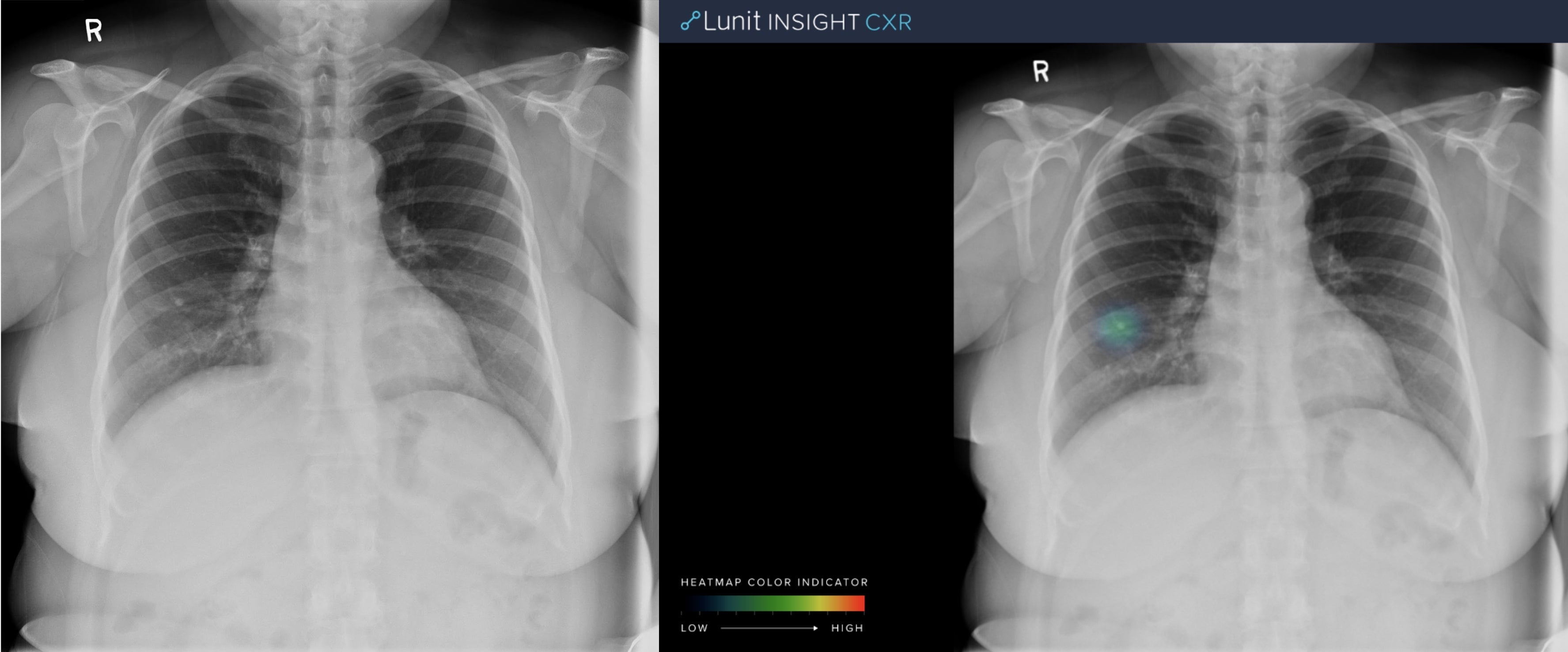 RSNA 2019: AI as a Peer-Review Tool