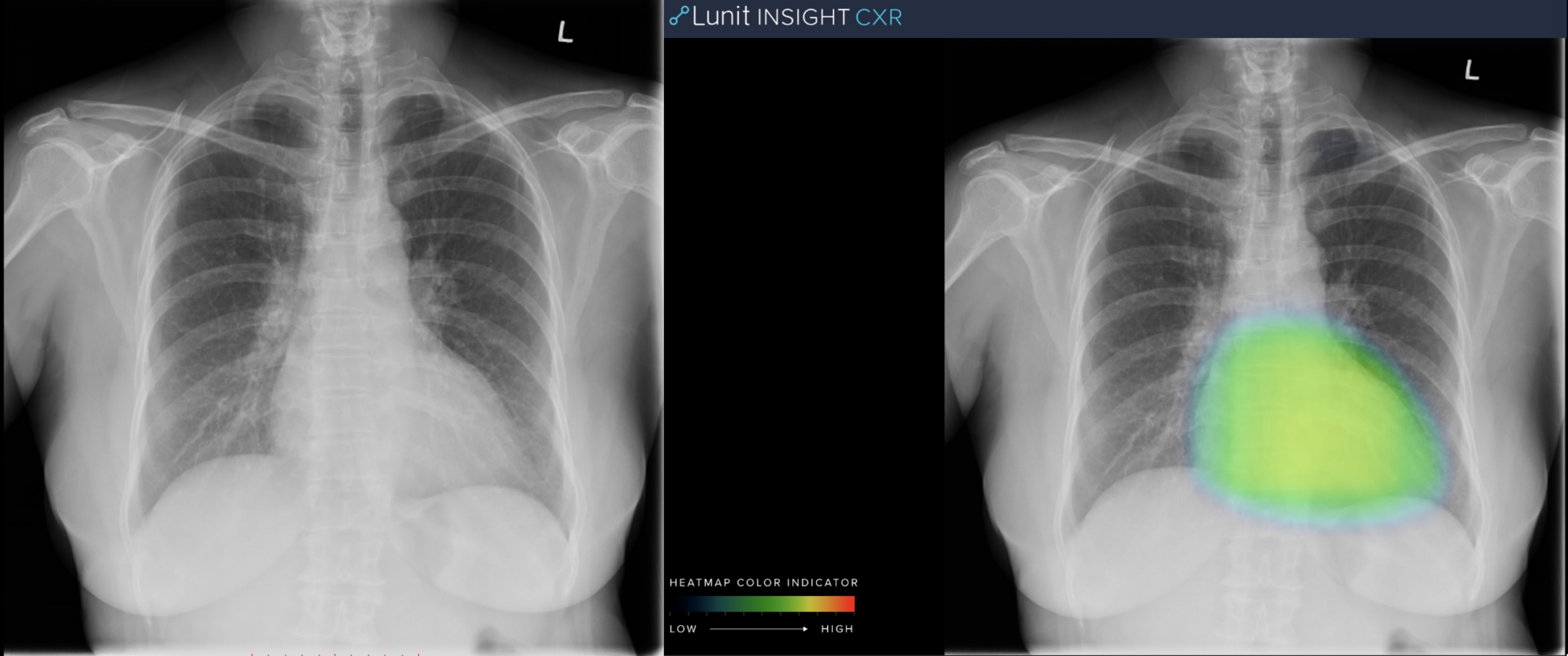 RSNA 2019: AI as a Peer-Review Tool