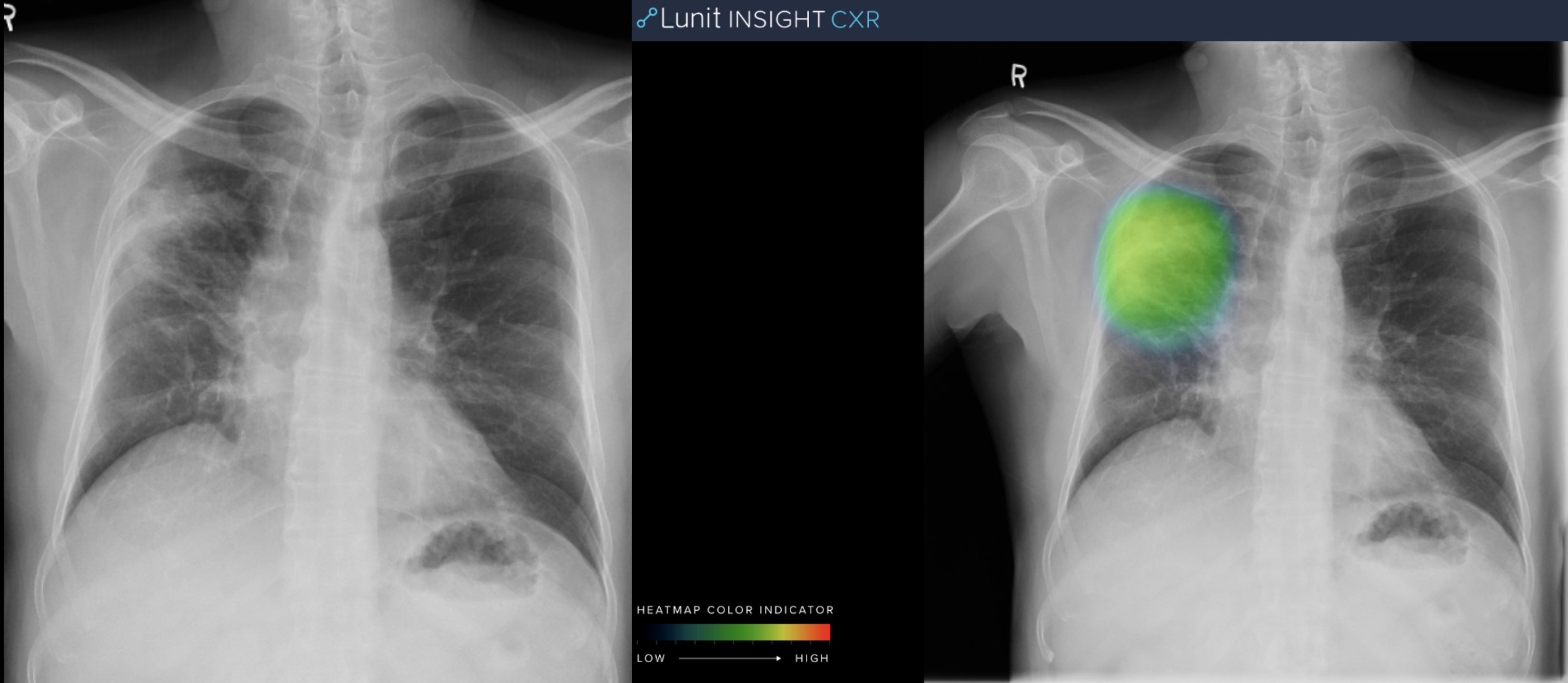 RSNA 2019: AI as a Peer-Review Tool