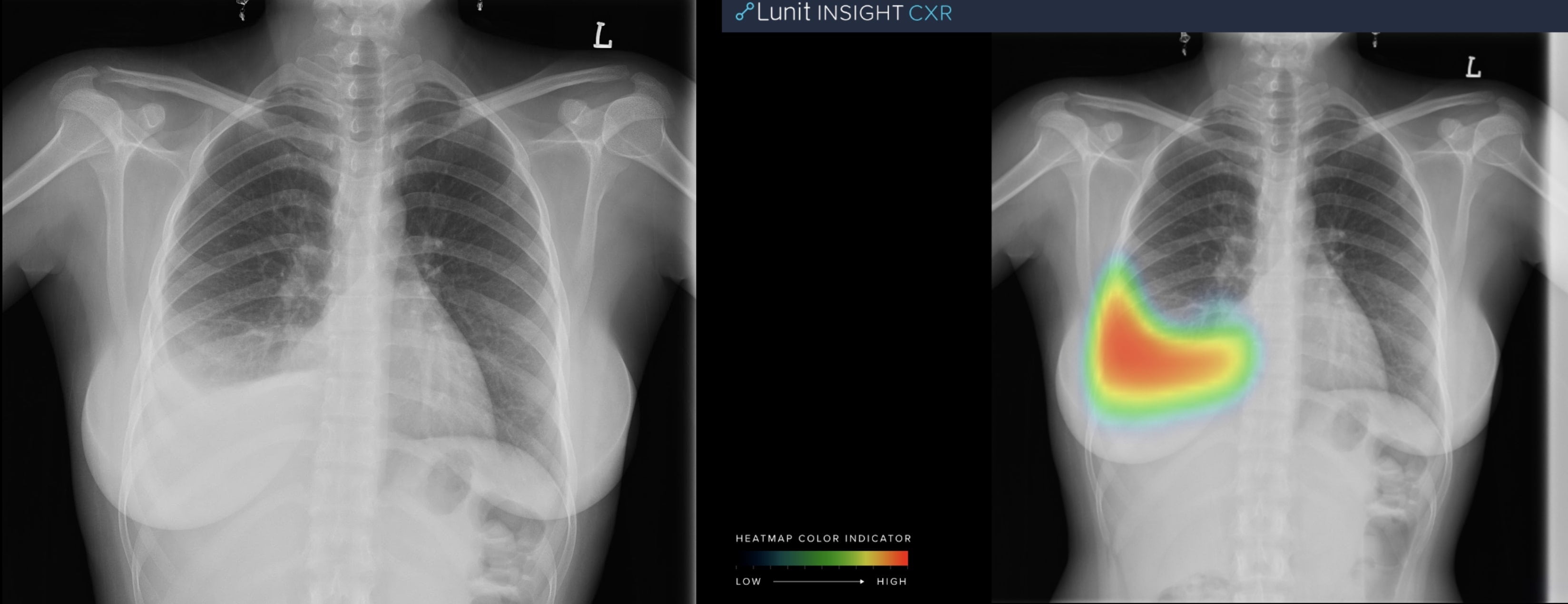 RSNA 2019: AI as a Peer-Review Tool