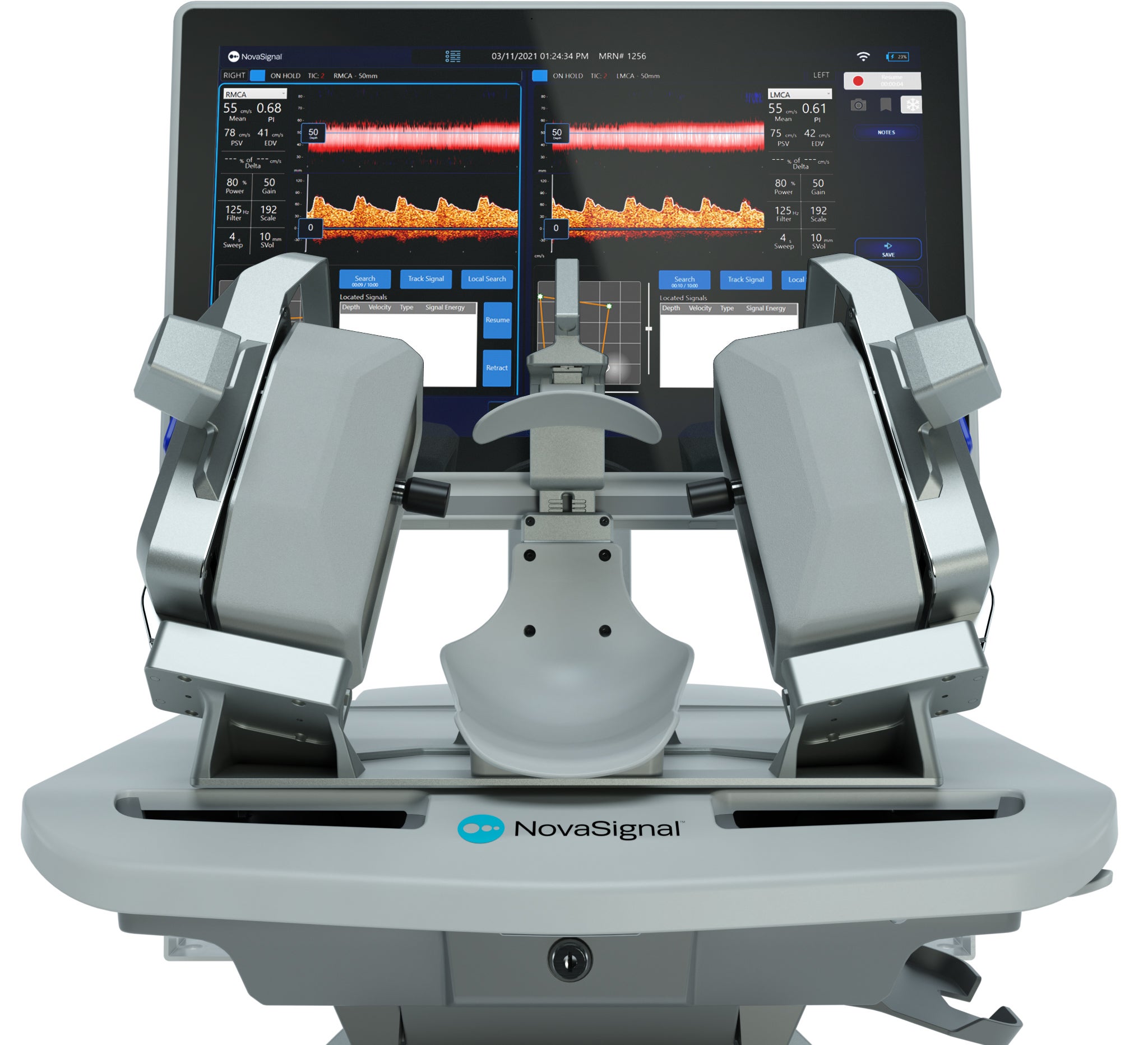 New Ultrasound Platform for Cerebral Blood Flow Measurements