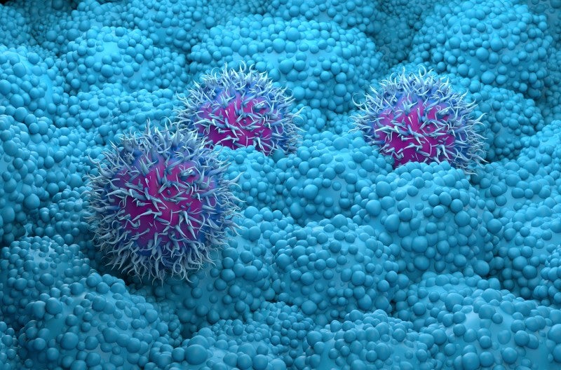 Pancreatic Cancer Vaccine With Immunotherapy and Antibody Increases Immune System Response