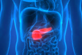 Baseline Imaging May Improve Early Detection of Pancreatic Cancer in High-Risk Individuals
