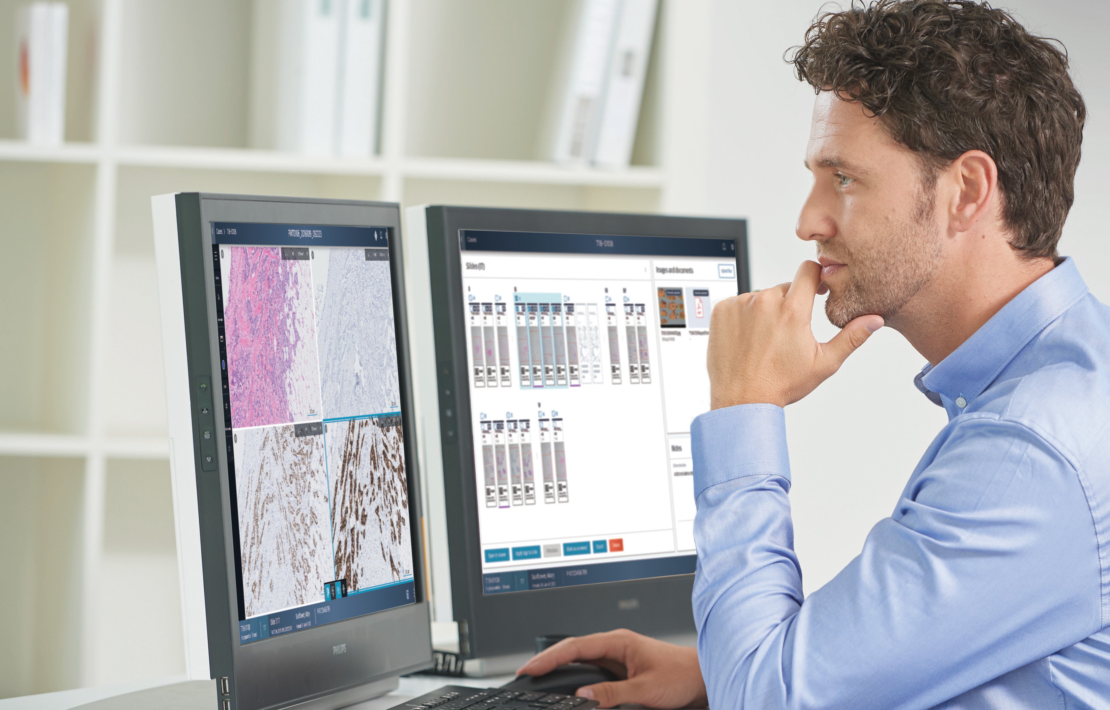 Philips, Ibex Medical Analytics Collaborate on AI-powered Digital Pathology