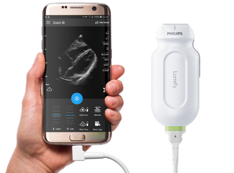 Philips Adds Hemodynamic Capabilities to Handheld Ultrasound