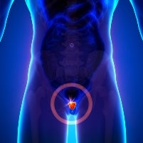 New Prostatic Artery Embolization Guidelines Released by Society of Interventional Radiology (SIR)